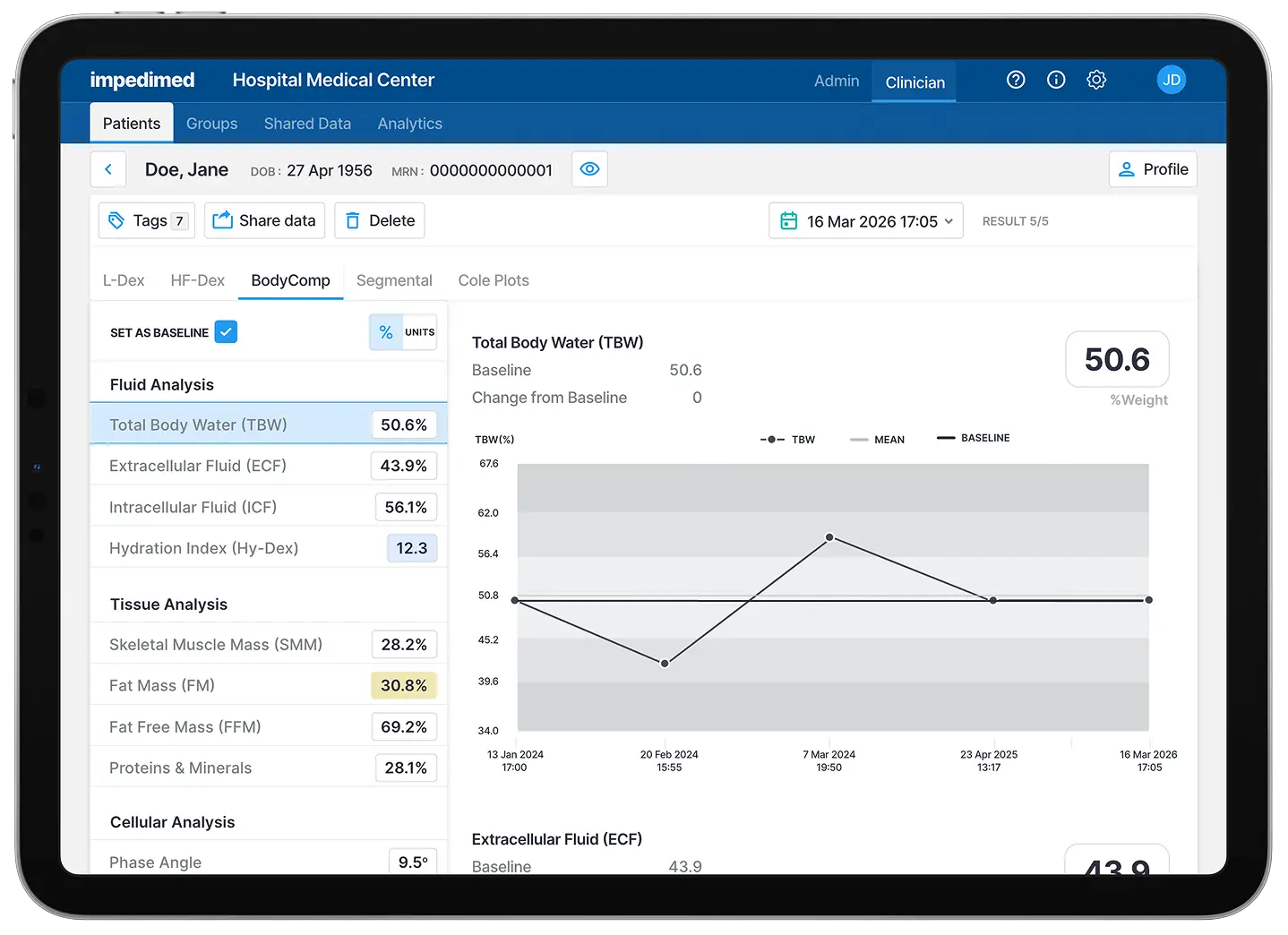 SOZO Pro Tablet